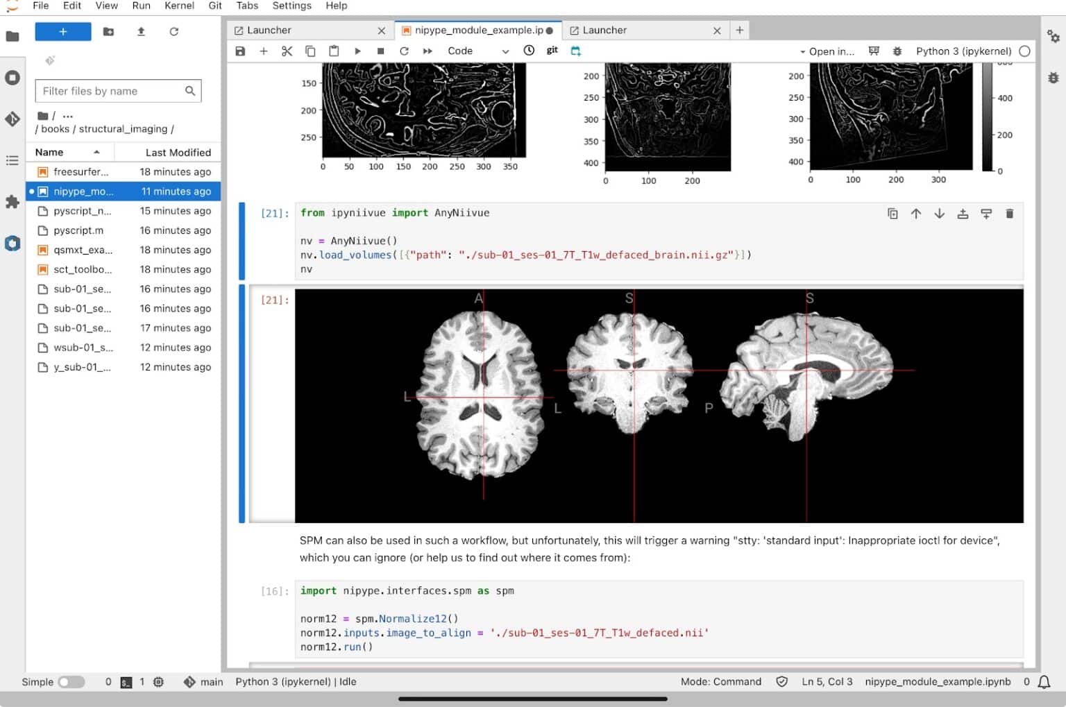 Neurodesk: an Accessible, Flexible and Portable Data Analysis ...