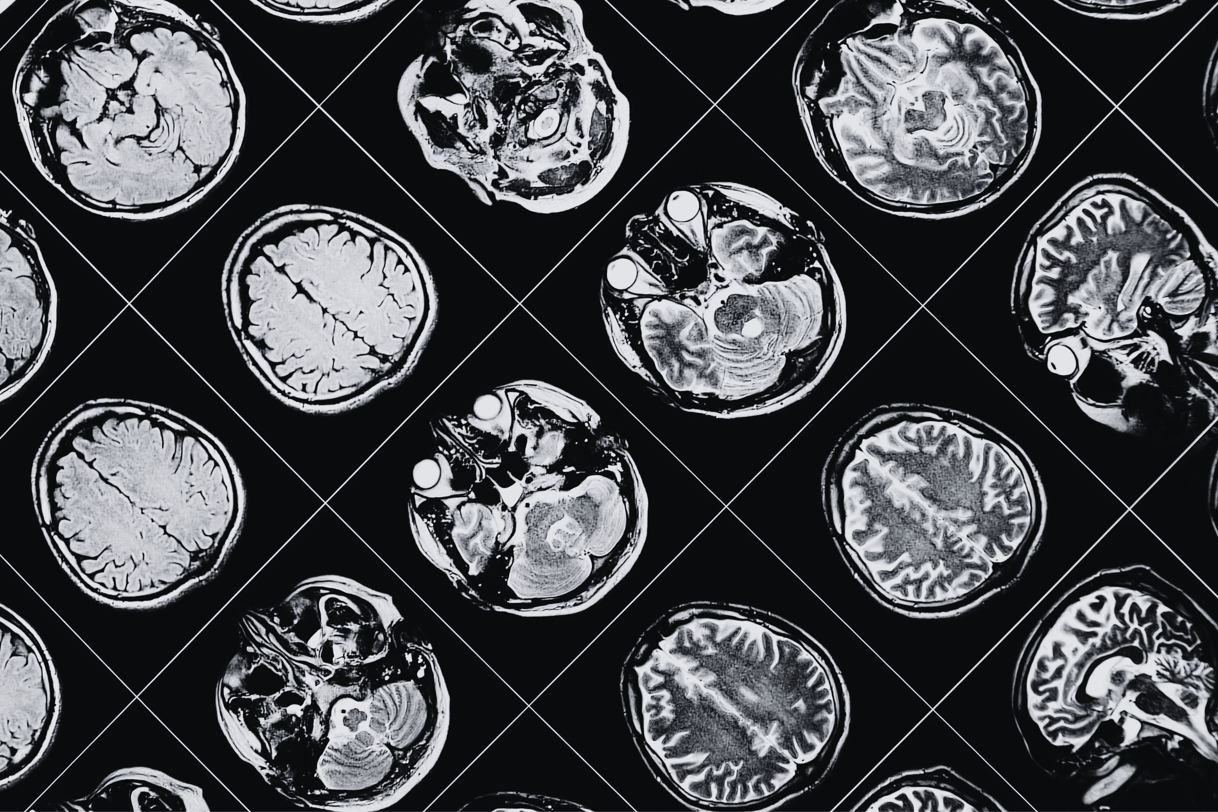 Teaching Neuroimaging Data Analysis in the Cloud using NeuroDesk - EGI